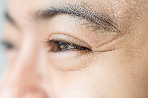 Forehead wrinkles are one of the common signs of skin aging